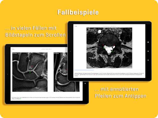 MRI Essentials screenshot 12
