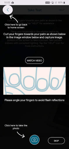 AnemoCheck Mobile screenshot 2