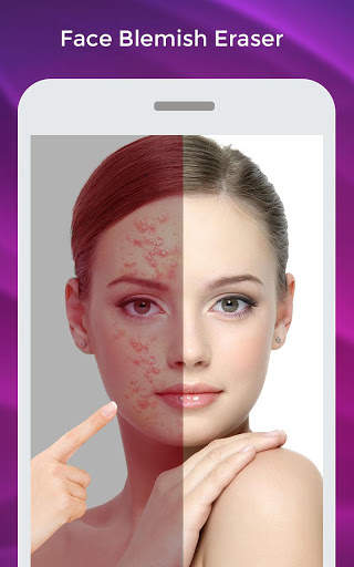 Face Blemish Eraser makeup screenshot 1