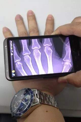 Xray Scanner screenshot 2