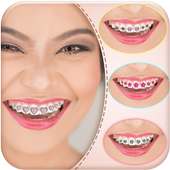 Decorate your Smile with Braces App logo