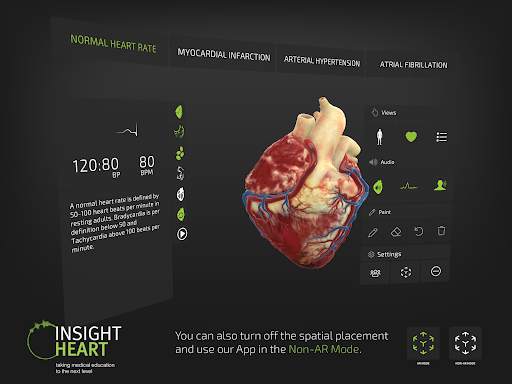 INSIGHT HEART Lite screenshot 7