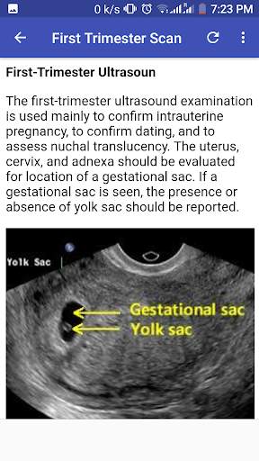 Ultrasound Guide A2Z screenshot 9