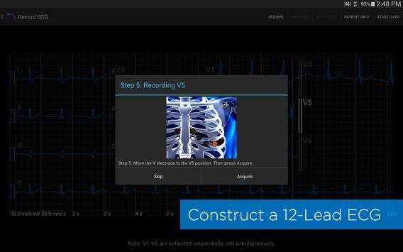 Alirus ECG screenshot 3