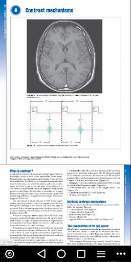 MRI - Regional Anatomy of the Brain Using MRI screenshot 7