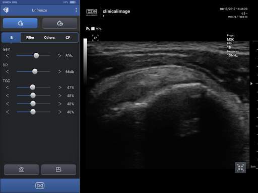 SONON Ultrasound App screenshot 2