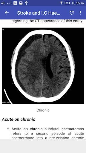 CT Brain Interpretation 7 تصوير الشاشة