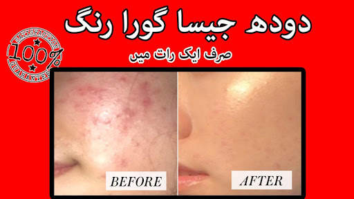 Beauty tips in urdu screenshot 1