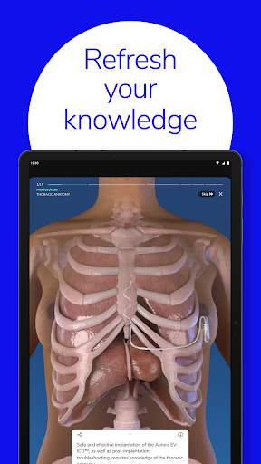 Touch Surgery: Surgical Videos screenshot 12