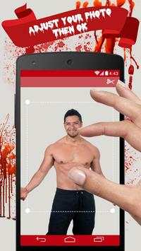 Injury Photo Editor screenshot 4